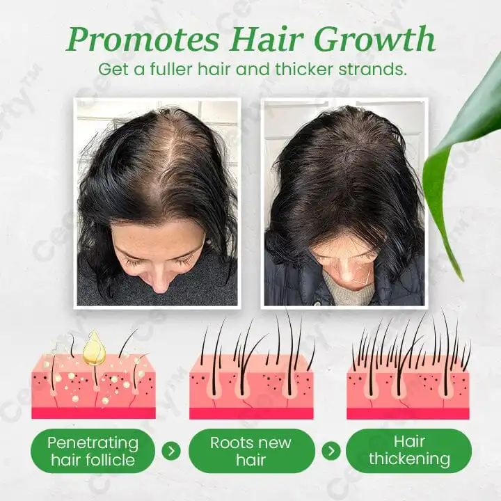 ReGenix Hair Growth Serum - Image 4