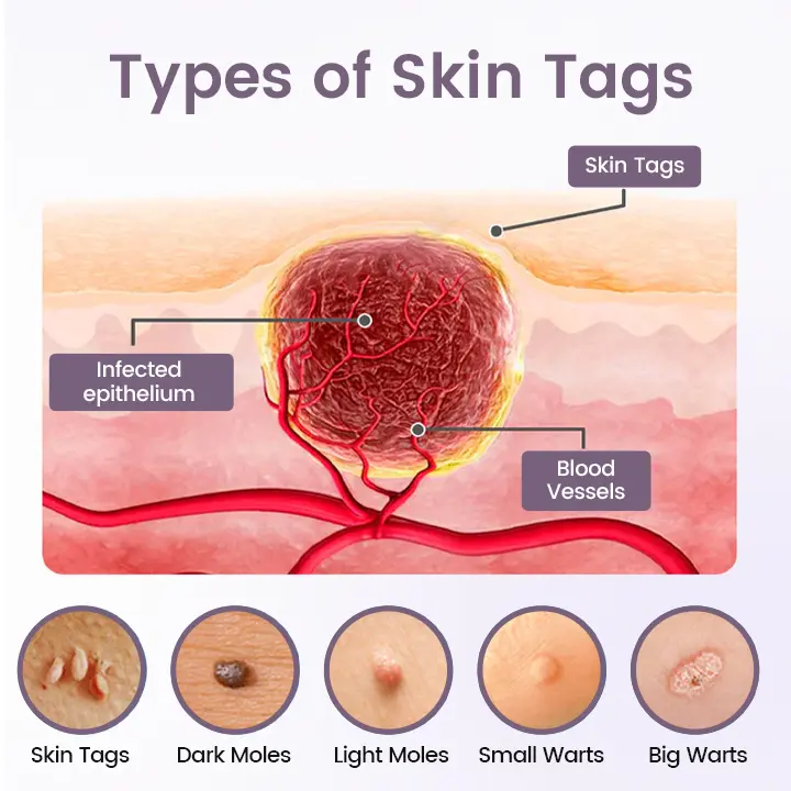 WartSmooth Renewal Serum - Image 8