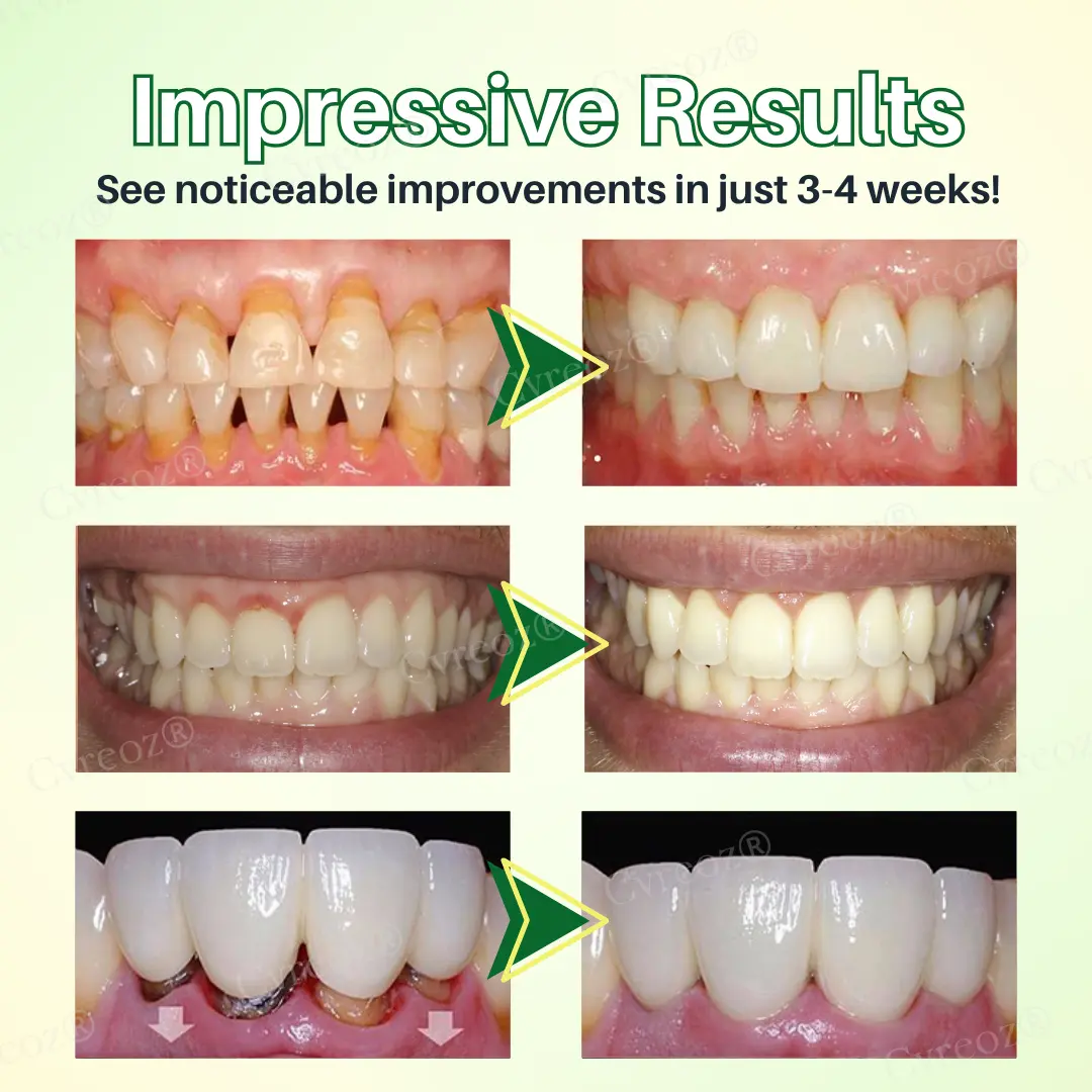 Propolis Oral Health Spray - Image 2