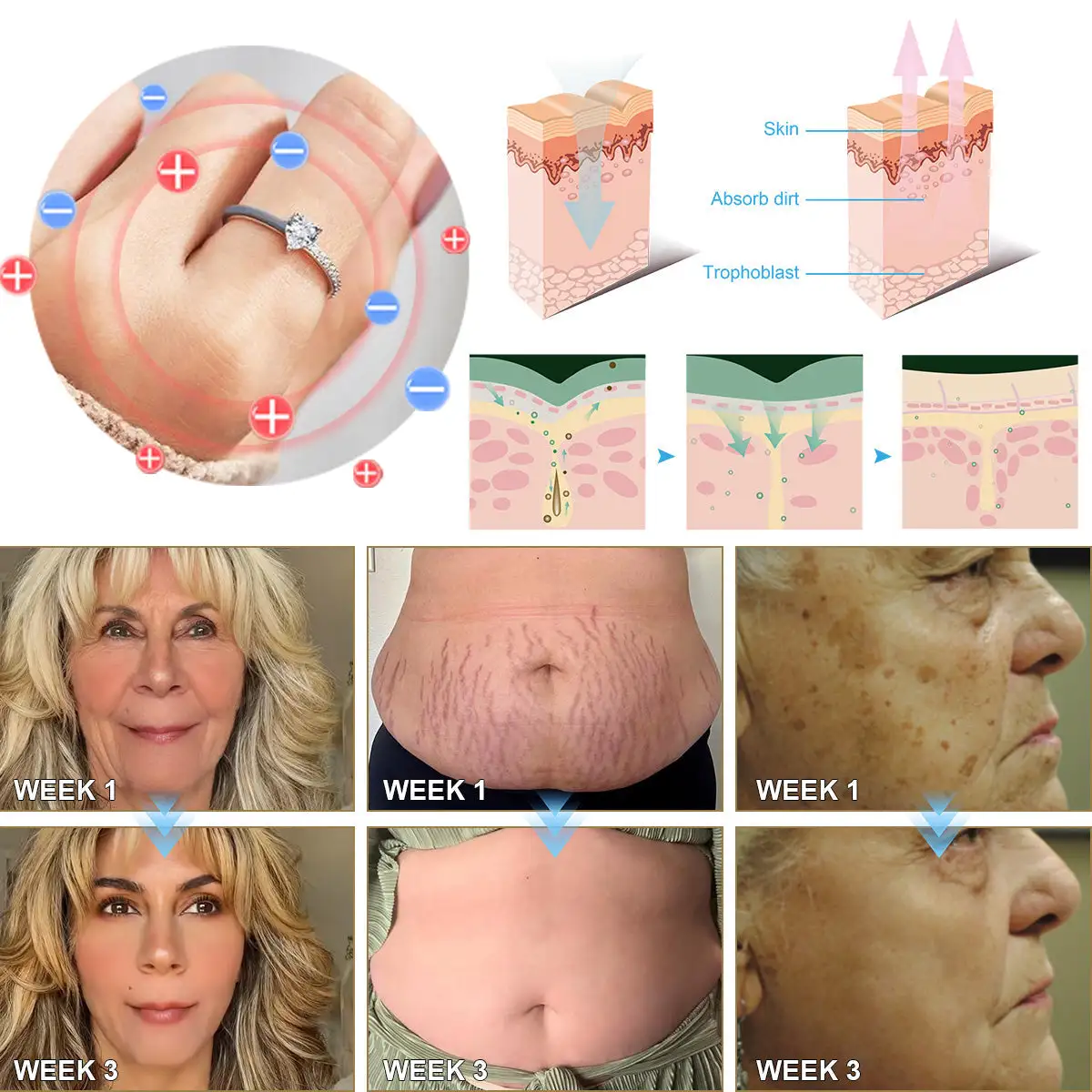 Magnetic Lymp Drainage Health Ring - Image 4