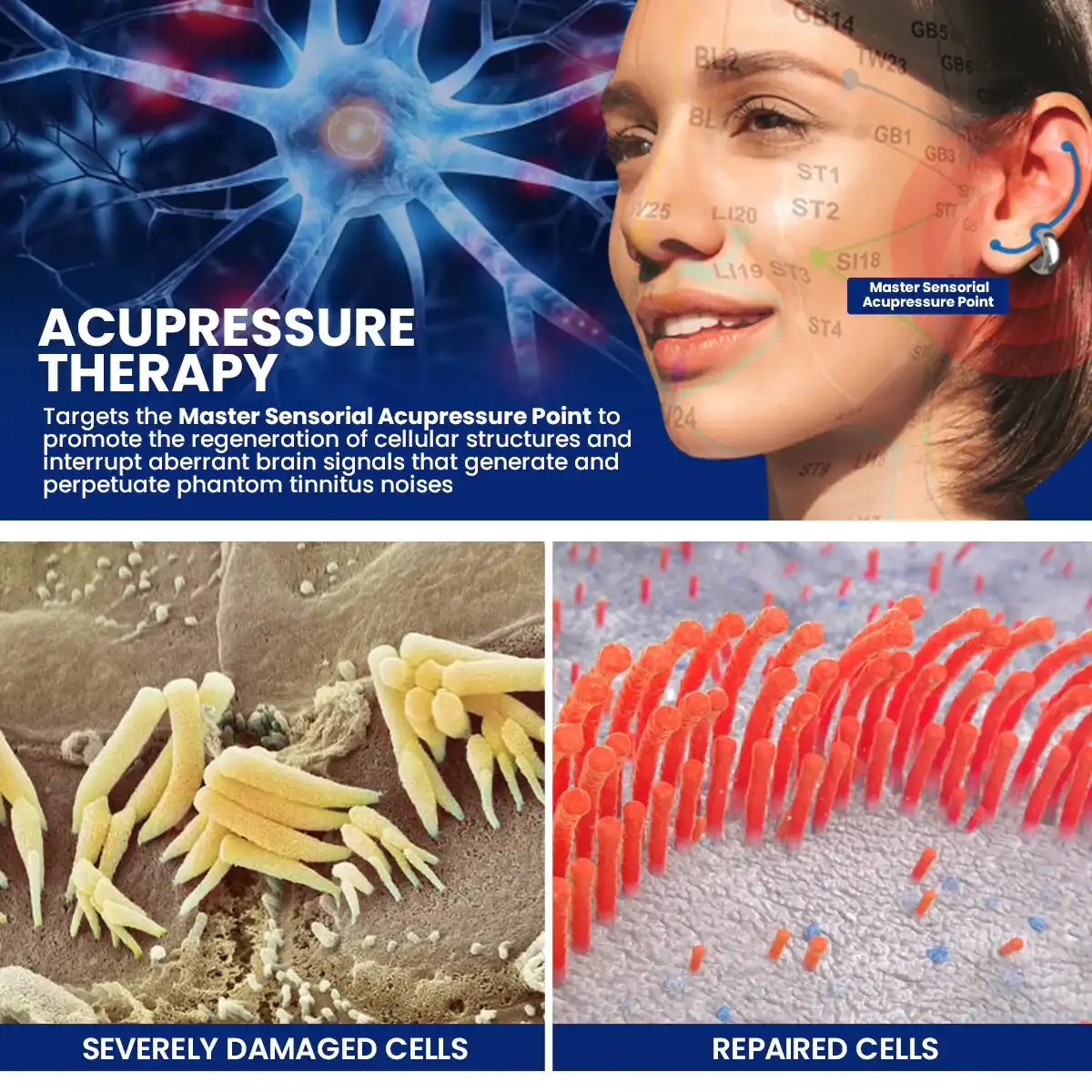 Acupressure Tinnitus Relief Earring - Image 3