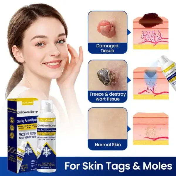 ChillErase Bump & Skin Tag Renewal Spray - Image 7