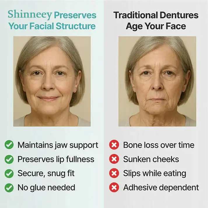 Custom-Fit Full Functional Dentures - Image 4