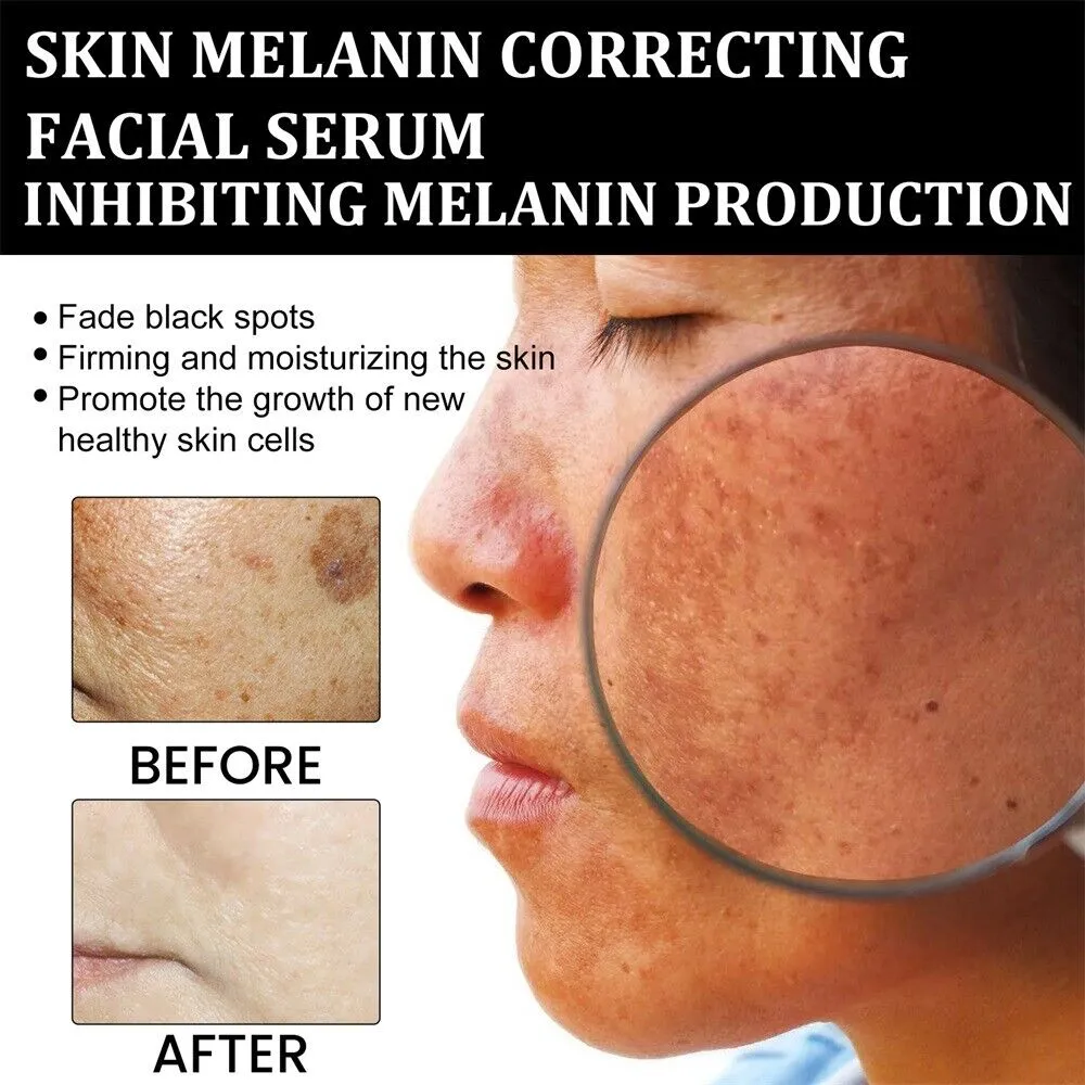 Melanin Correcting Facial Serum - Image 3