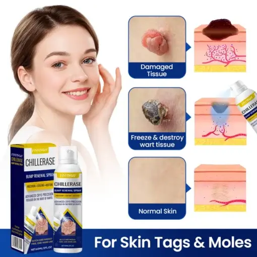 ChillErase Bump Renewal Spray - Image 7