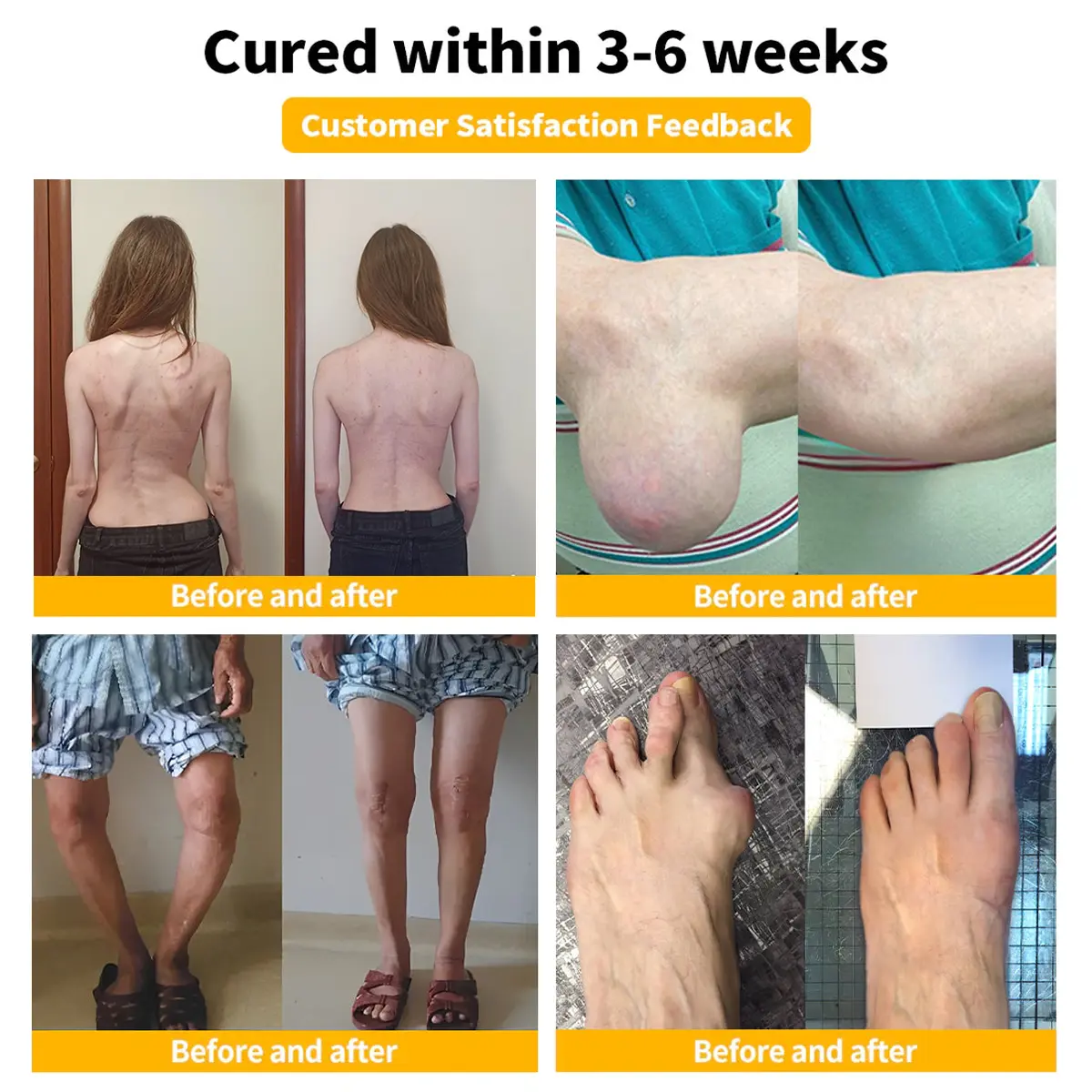 Bee-Venom Pain-Relief Bone Healing Cream - Image 2