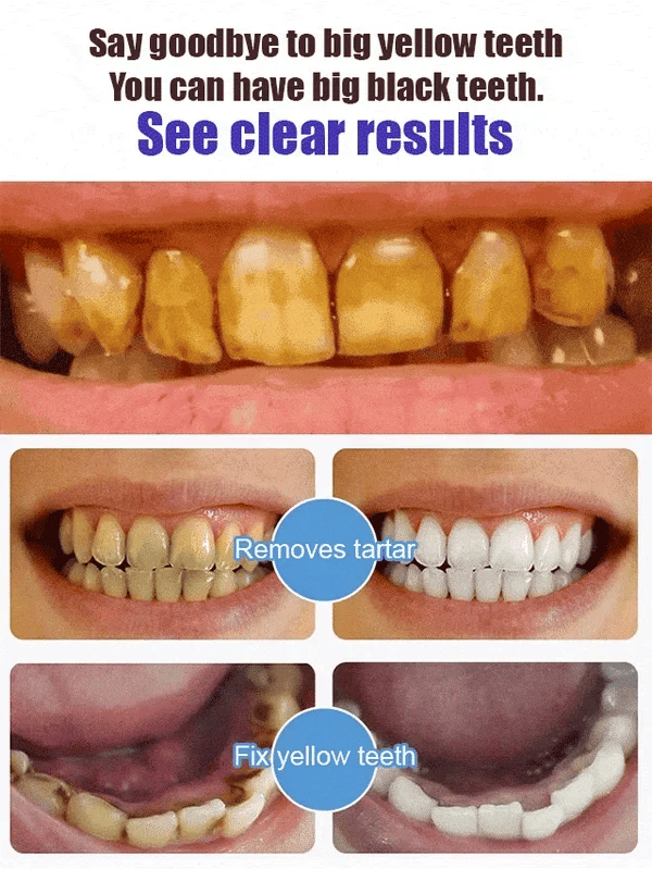 SP-6 Probiotic Ultra Whitening Toothpaste - Image 3