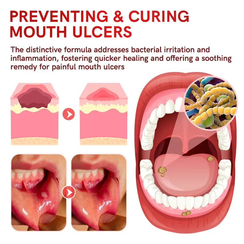 SP-6 Probiotic Ultra Whitening Toothpaste - Image 4