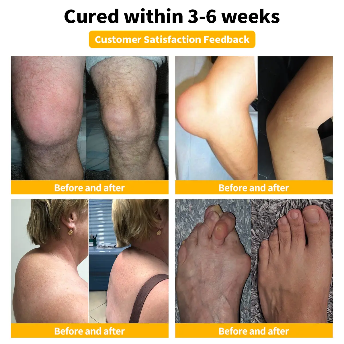 Bee Venom Joint and Bone Cream - Image 2