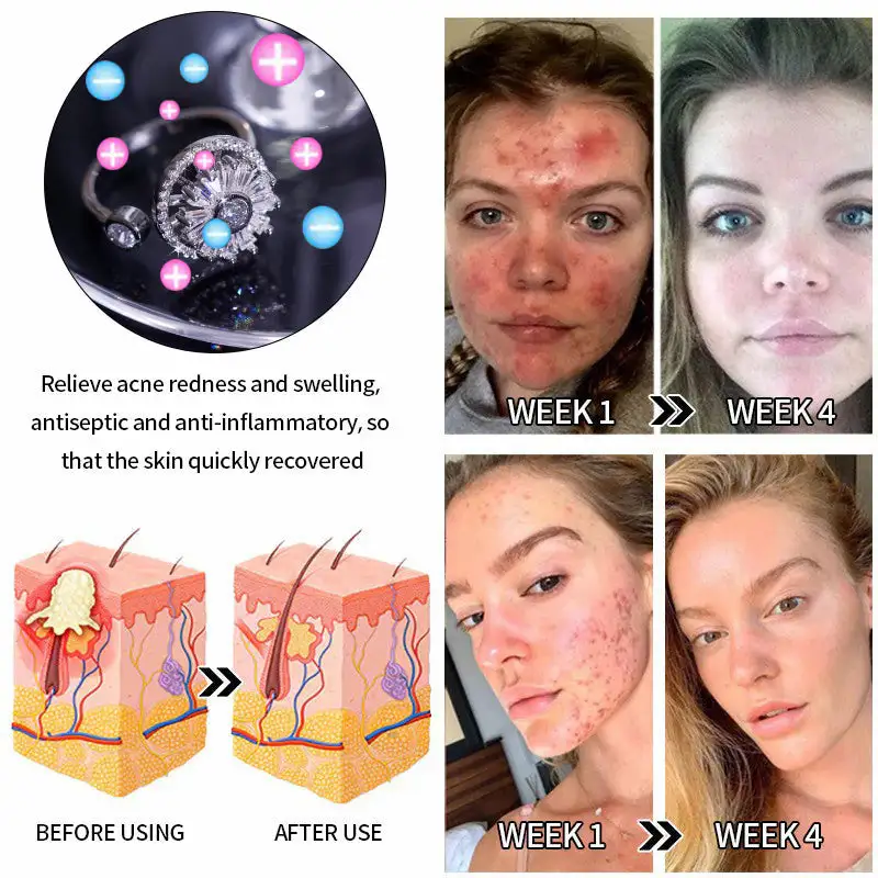 Lymphatic Magnetic Detox Spinning Ring - Image 6