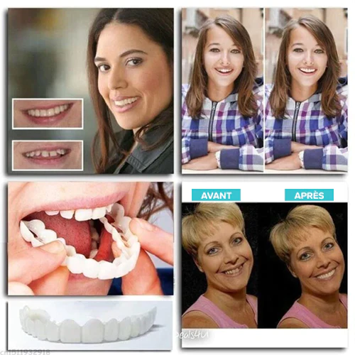 Prothèses ajustables à clipser - Image 6