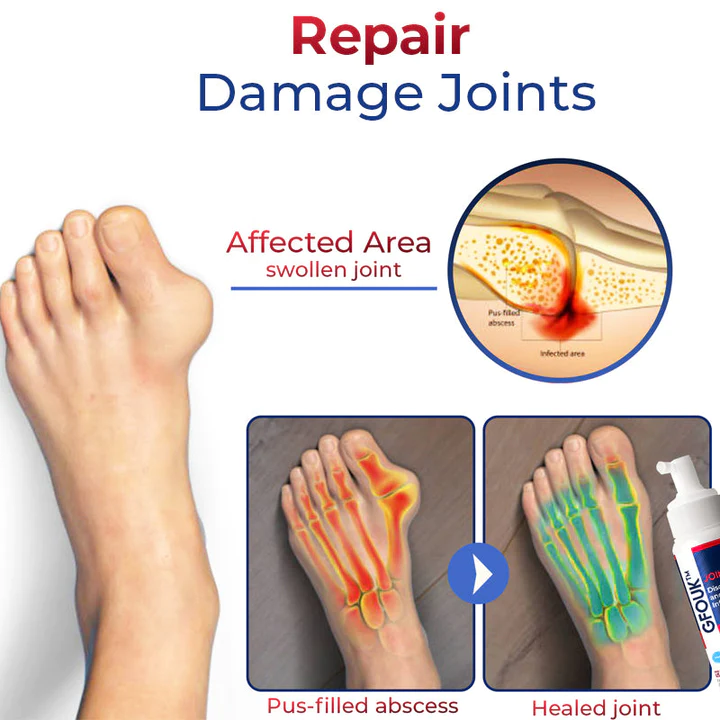 JointMax Discomfort and Inflammation Relief Foam - Image 3