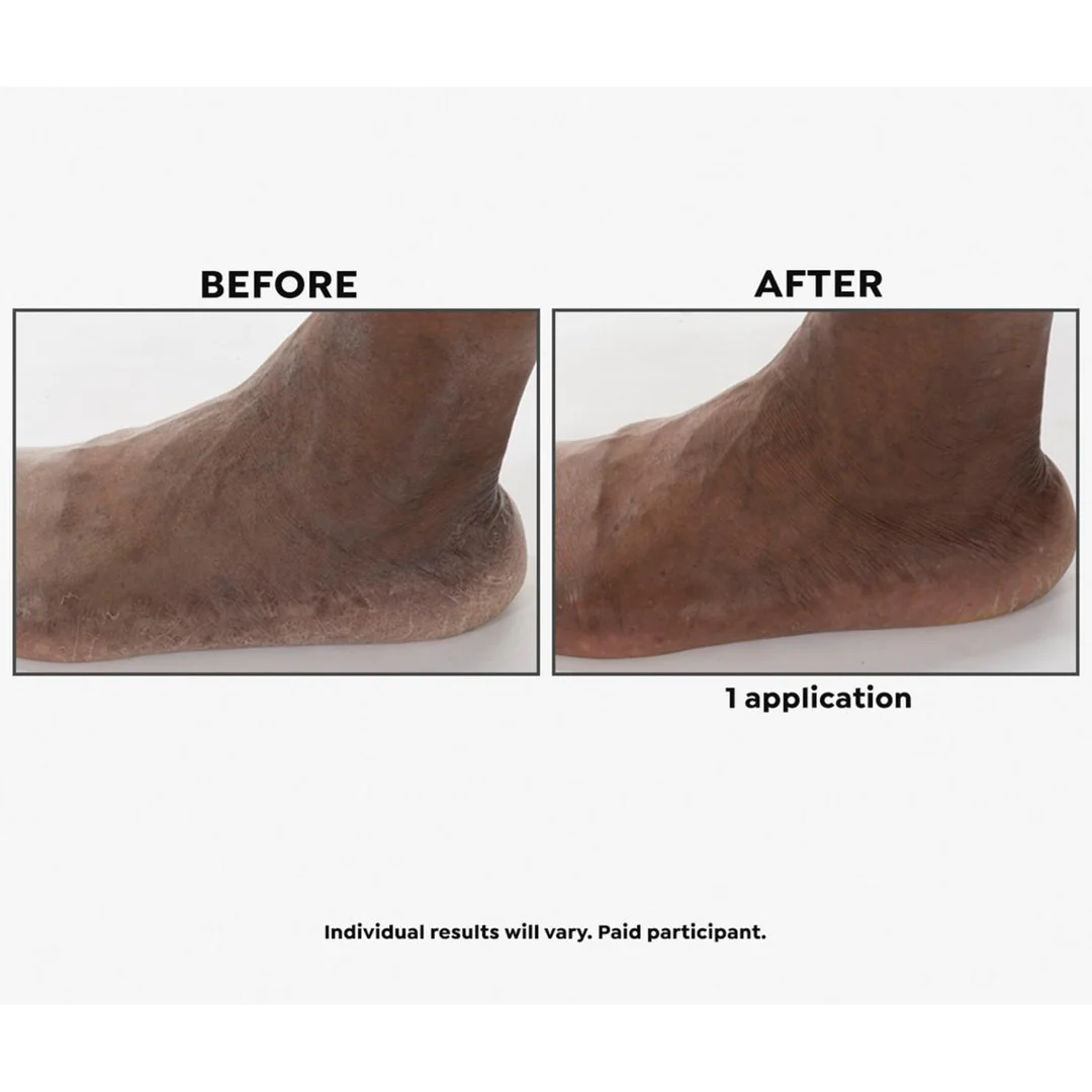 Imperial Honey Deluxe 2-piece Kit - Image 4