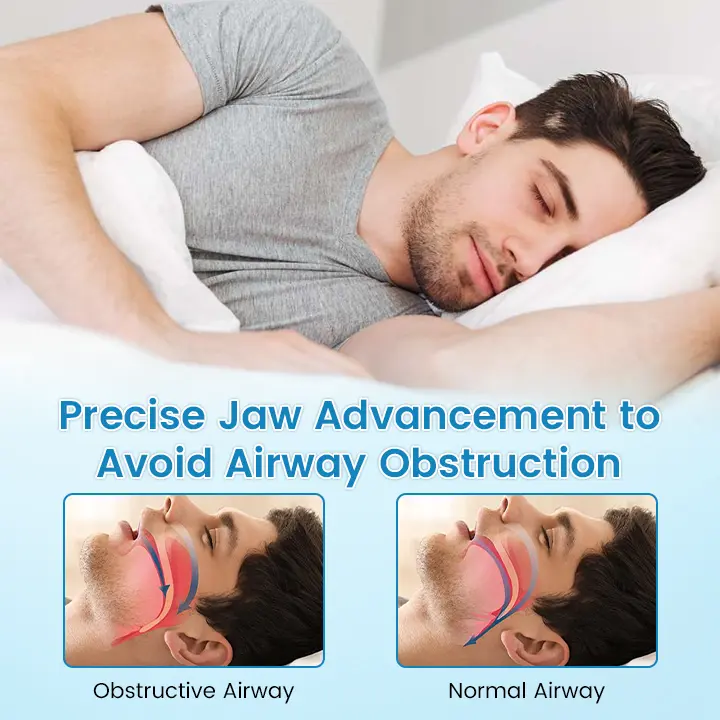 Anti-Snoring & Anti-Grinding Teeth Protector - Image 7