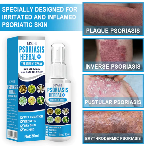 Psoriasis Herbal Treatment Spray - Image 5