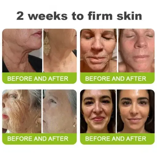 Botox Vitamin A Retinol Anti-Wrinkle Firming and Lifting Cream Last Day for Limited Time 70 OFF - Image 4