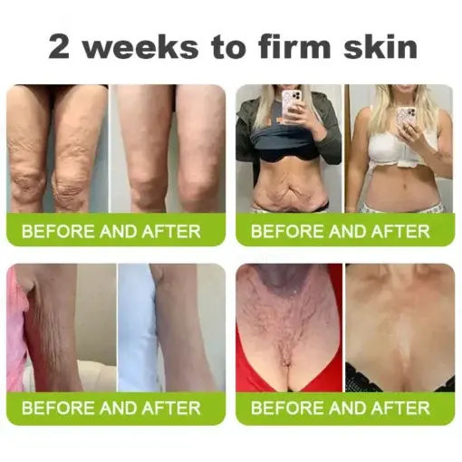 Botox Vitamin A Retinol Anti-Wrinkle Firming and Lifting Cream Last Day for Limited Time 70 OFF - Image 6