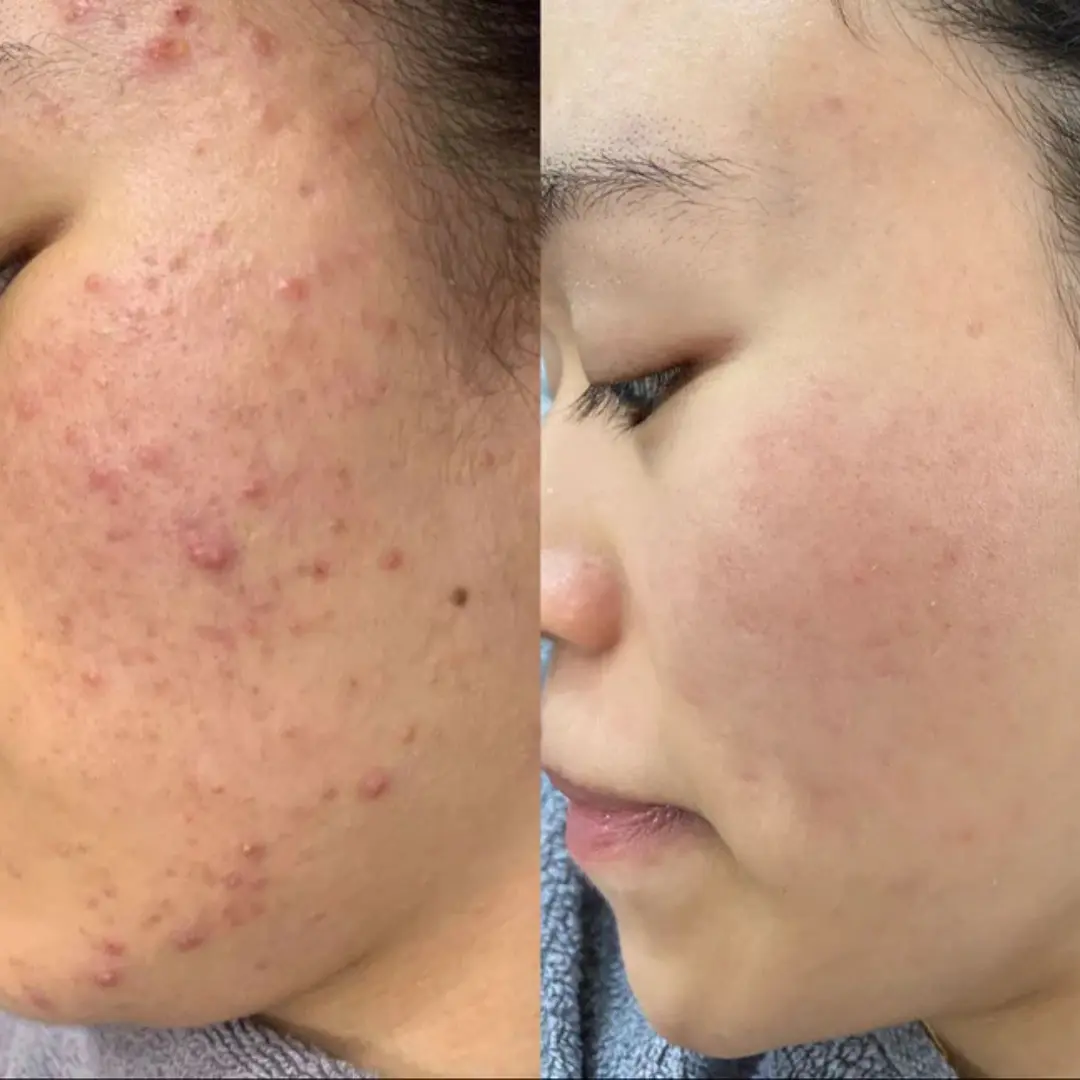 Facial Cream with 7% Arbutin + 4% Tranexamic Acid - Image 2