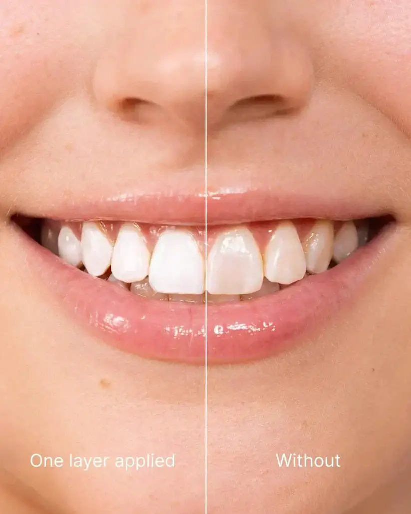 Tooth Polish - Instant Whitening for a Sparkling Smile - Image 6
