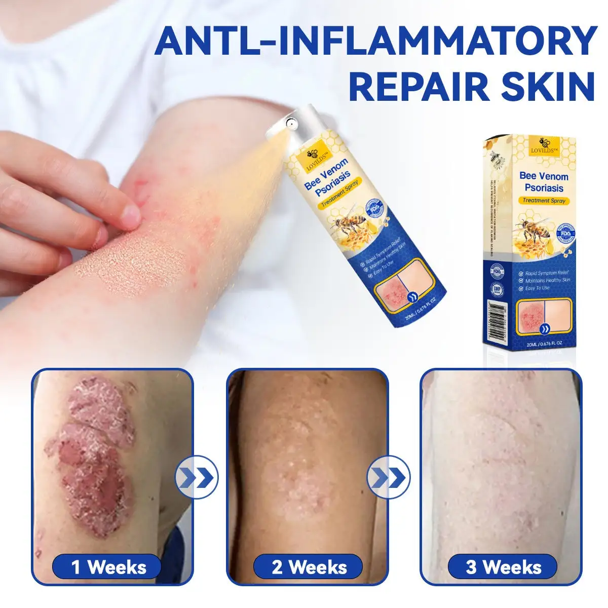 PsoriaHeal Bee Venom Psoriasis Treatment Spray - Image 7