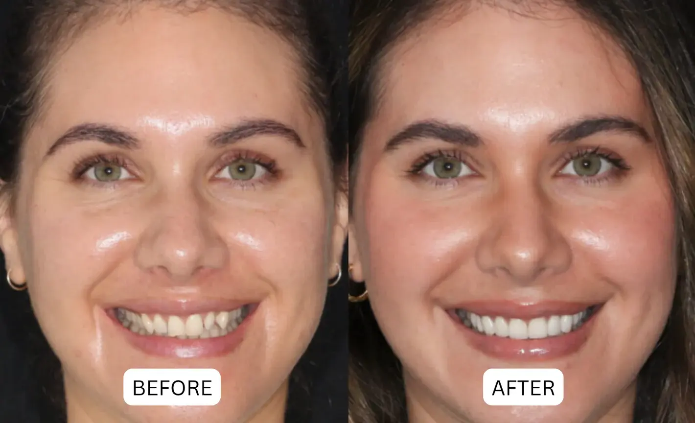 Teeth Armor Drops - Image 6