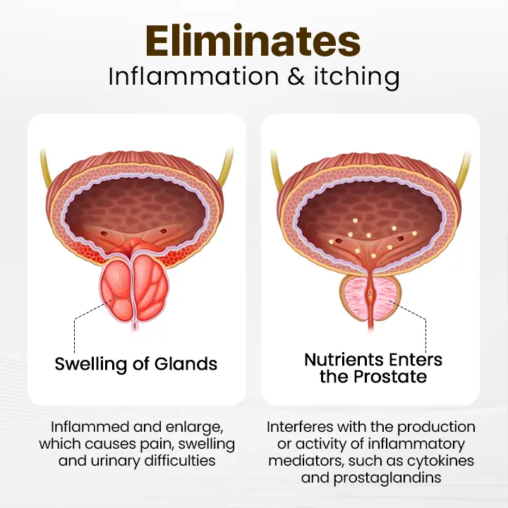 Prostate Massage Bee Wellness Inhaler - Image 6