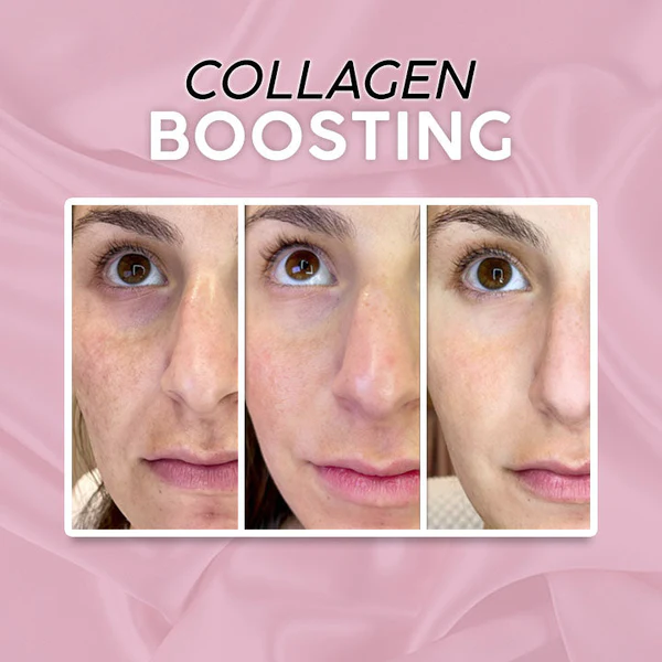 Magic Anti-Wrinkle Eye Cream - Image 4