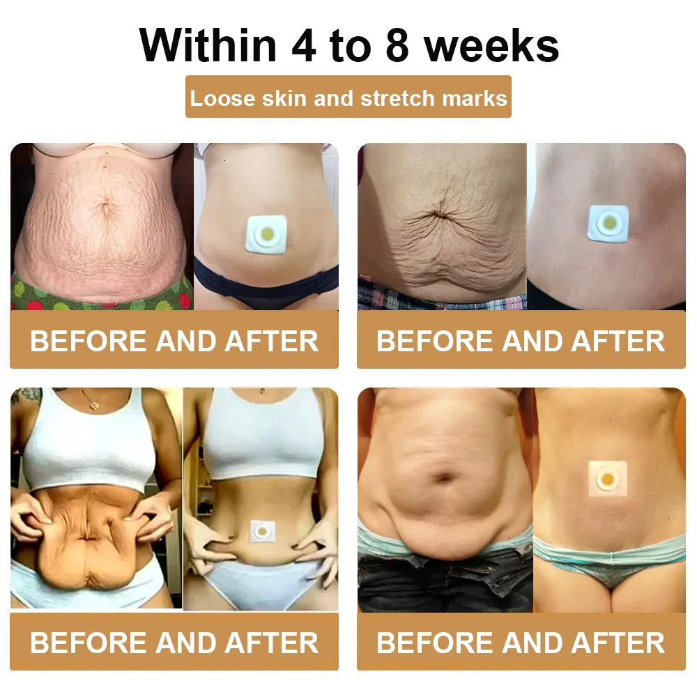 πππ πππ§π¨π¦ ππ²π¦π©π‘πππ’π ππ«ππ’π§ππ π ππ₯π’π¦π¦π’π§π πππππ‘ - Image 10