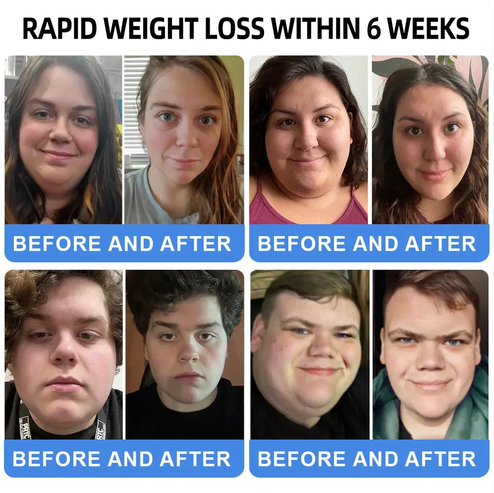 Nano Microneedle Patch - Image 2