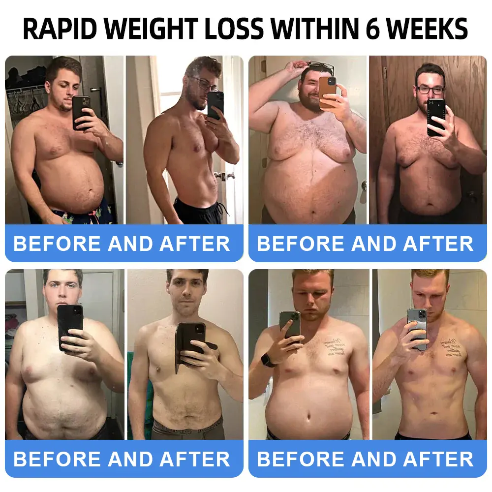 NIDDK-Tirzepatide Nano Microneedle Patch - Image 3