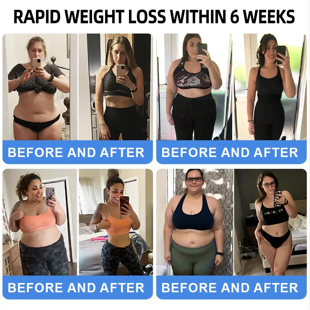 NIDDK-Tirzepatide Nano Microneedle Patch - Image 4