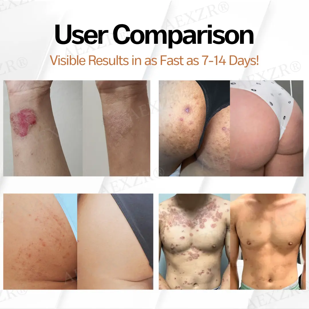 New Zealand Manuka Honey All-in-One Cream - Image 2