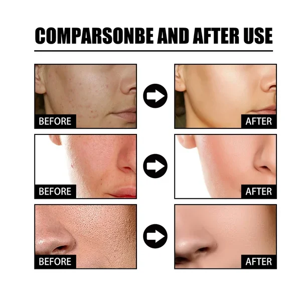 Niacinamide Facial Essence - Image 4