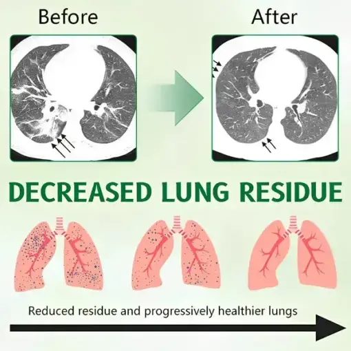 3X Concentrated Mullein Lung Cleanse Spray - Image 6