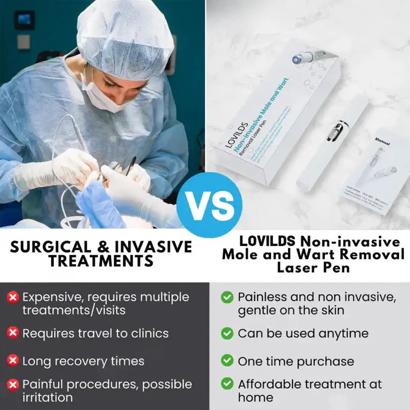 Non-Invasive Mole and Wart Removal Laser Pen - Image 4