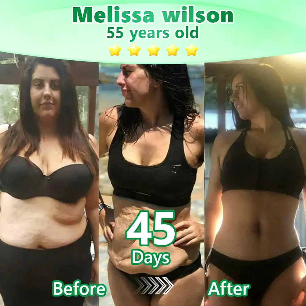 Slimming & Firming 2-in-1 Nano Microneedle Patchus - Image 4