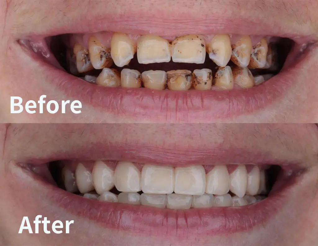 Gum Protect Repair Gel - Image 9