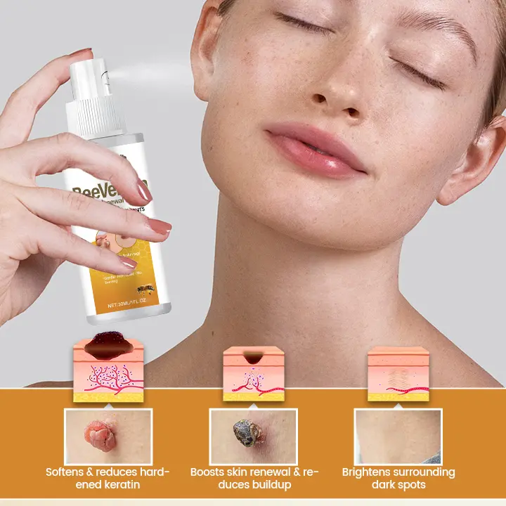 BeeVenom Wart Renewal Spray - Image 4