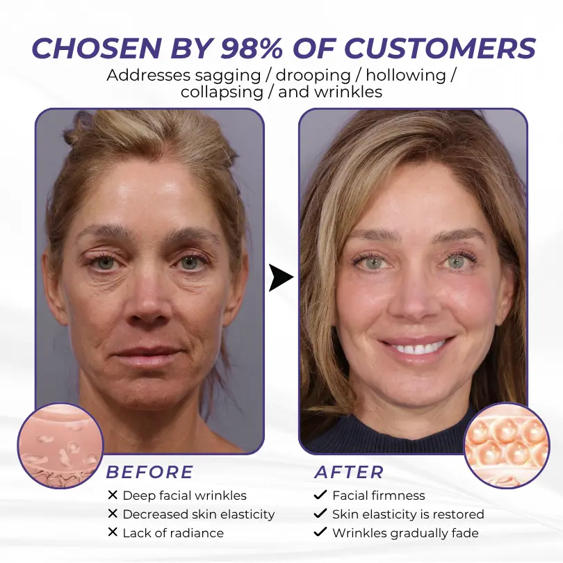 ElastaPro Emu Oil Skin Firming Cream - Image 10