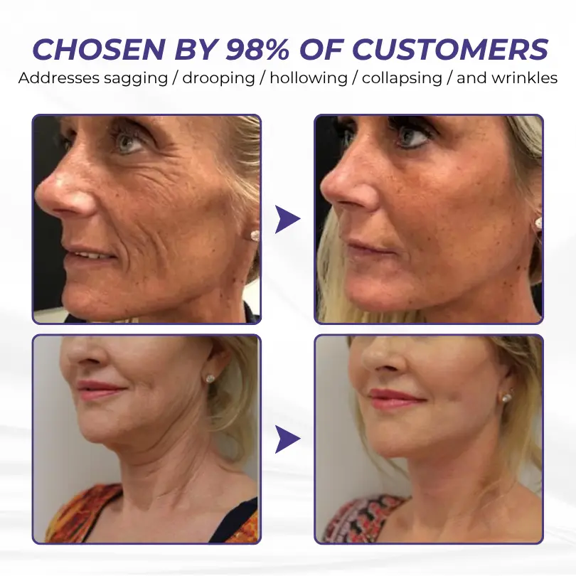 ElastaPro Emu Oil Skin Firming Cream - Image 9