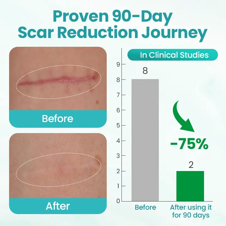 EliteAloe ScarSolve Spray - Image 4