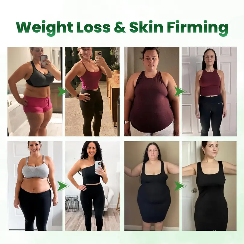 SculptAura Moringa • Berberin + NAD+ 10-in-1 Nano-Microneedle-Patch - Image 2