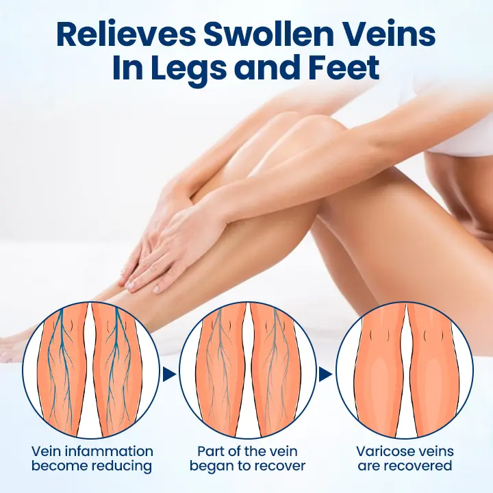 VenoRelief Botanical Leg Spray - Image 7