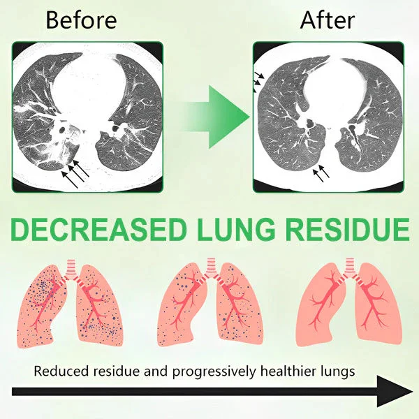 3X Concentrated Mullein Lung Cleanse Spray - Image 6