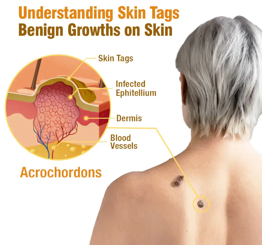 Bee Venom Tags Removal Cream - Image 7