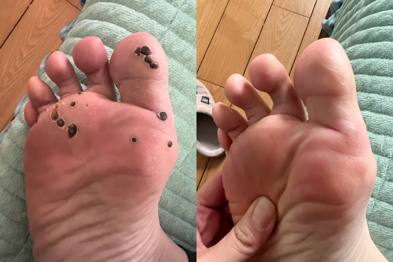 𝑩𝒆𝒆 𝑽𝒆𝒏𝒐𝒎 𝑴𝒐𝒍𝒆 𝒂𝒏𝒅 𝑾𝒂𝒓𝒕 𝑻𝒓𝒆𝒂𝒕𝒎𝒆𝒏𝒕 𝑶𝒊𝒏𝒕𝒎𝒆𝒏𝒕 - Image 8