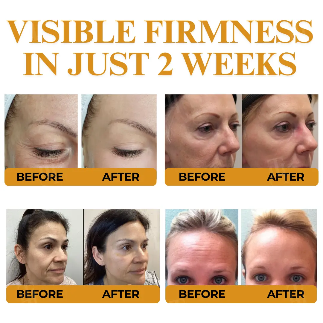 Letybo Bee Venom Wrinkle Removal Cream - Image 2