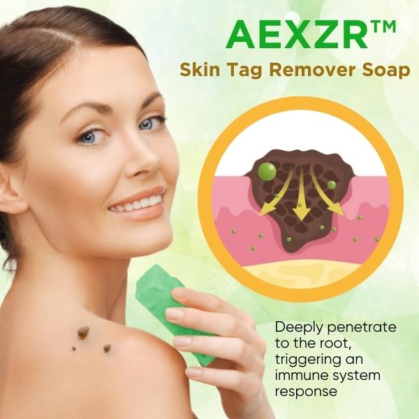 Skin Tag Remover Soap - Image 5