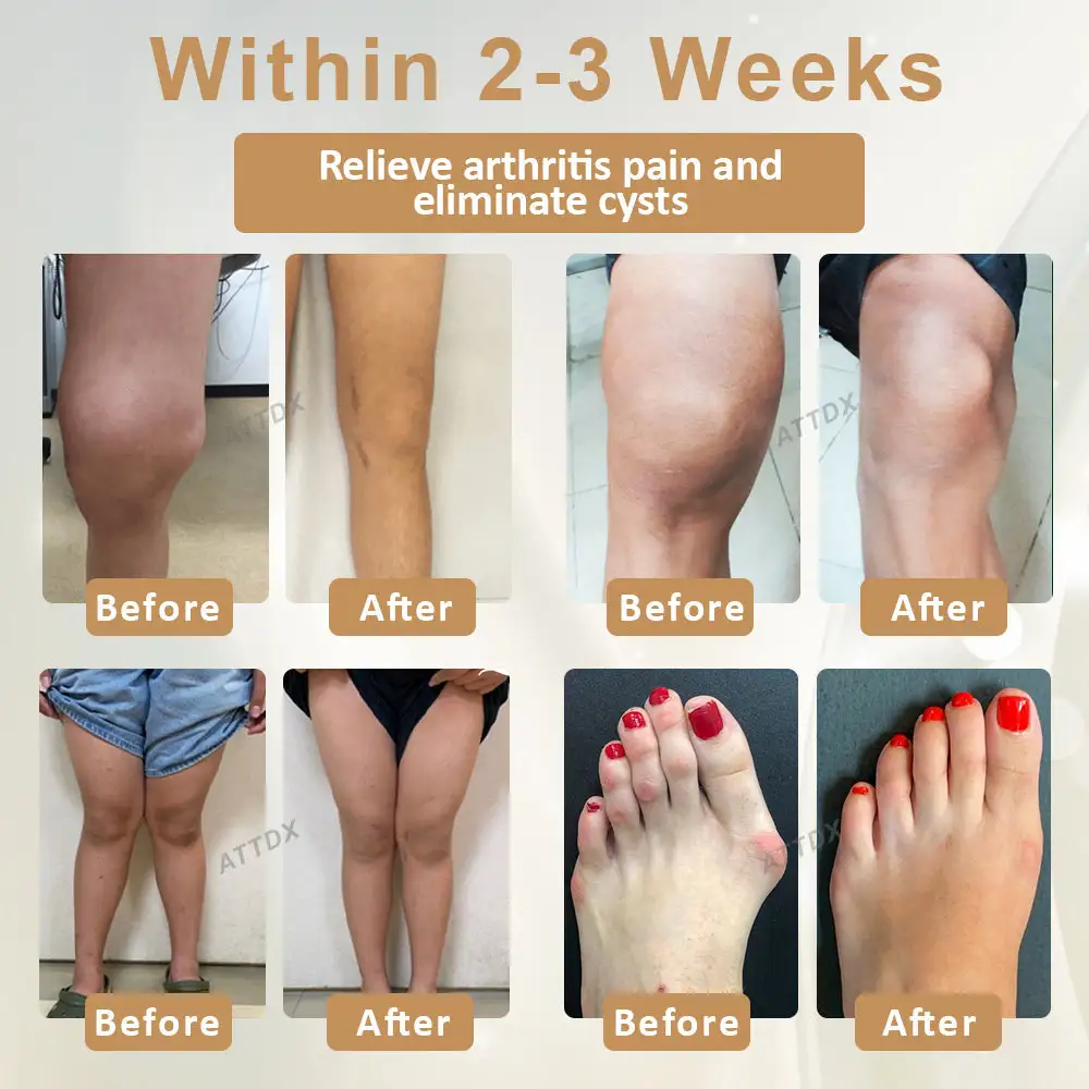 Emu Oil Turmeric Bone Sooth Gel - Image 3