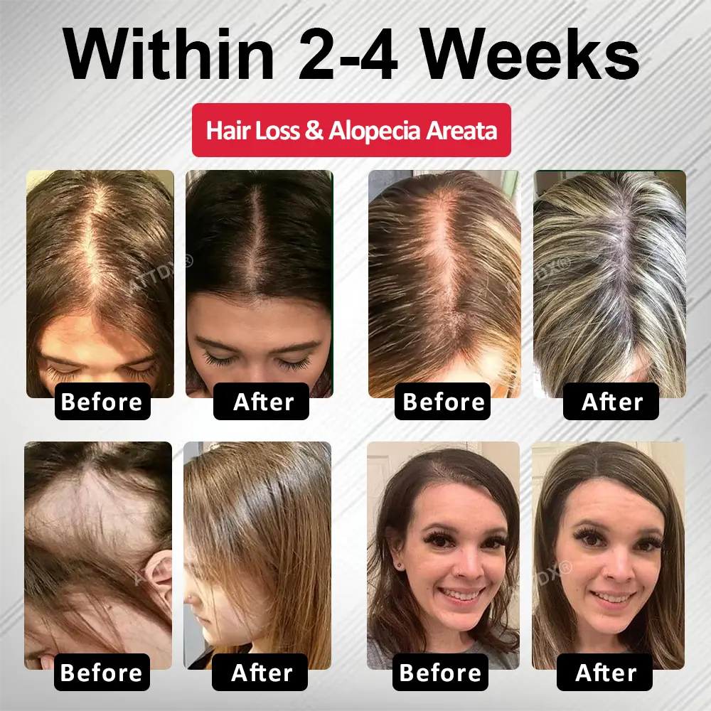 Hair Reawaken PP405 Roll-On Serum for Women - Image 3